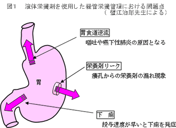 図1　液体栄養剤を使用した経管栄養管理における問題点