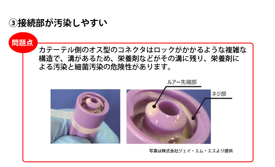 接続部が汚染しやすい