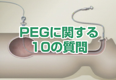 PEG（胃ろう）に関する10の質問