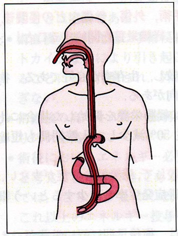 図1　胃全摘術　Roux-en Y吻合時の術後栄養用経鼻経腸栄養カテーテルの留置