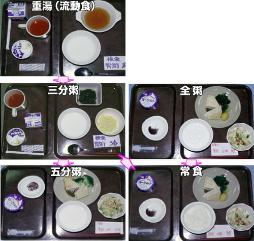 図6　本邦の術後段階食（都立大久保病院）