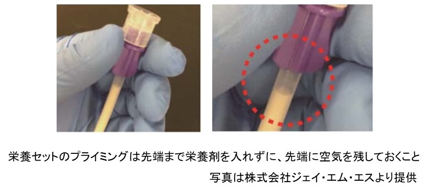 図5-4　経管栄養チューブ；コネクタ汚染予防のための栄養剤のプライミング方法
