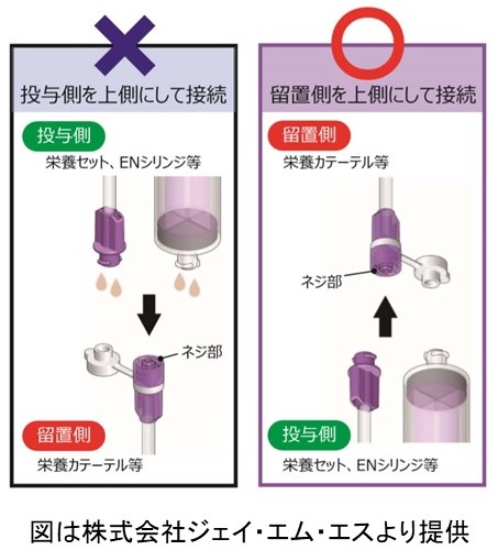 Chapter2 経腸栄養 10.経腸栄養に必要な器具｜PDNレクチャー