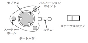 図２  CVポートとロック