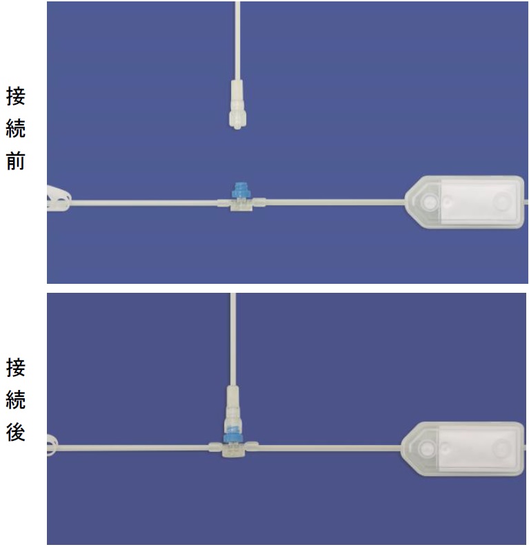 図3　輸液接続システム