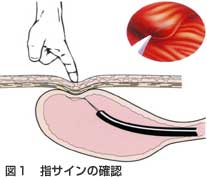 指サイン