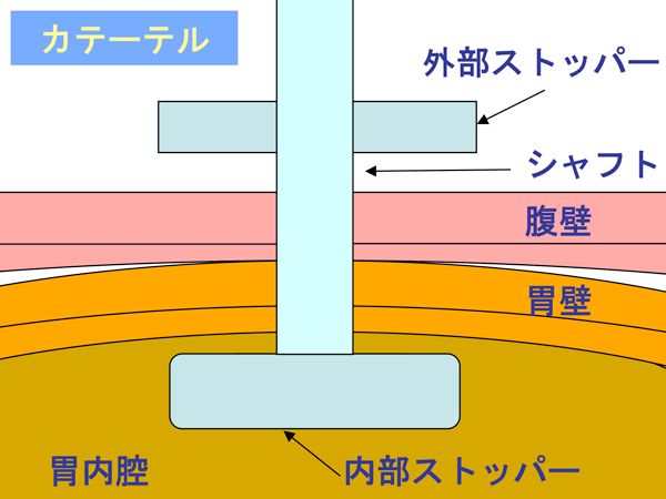 図２　PEGの構造