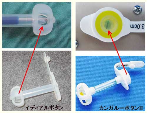 図５　逆流防止弁の位置