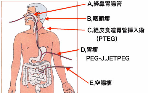 図１　経腸栄養ルート