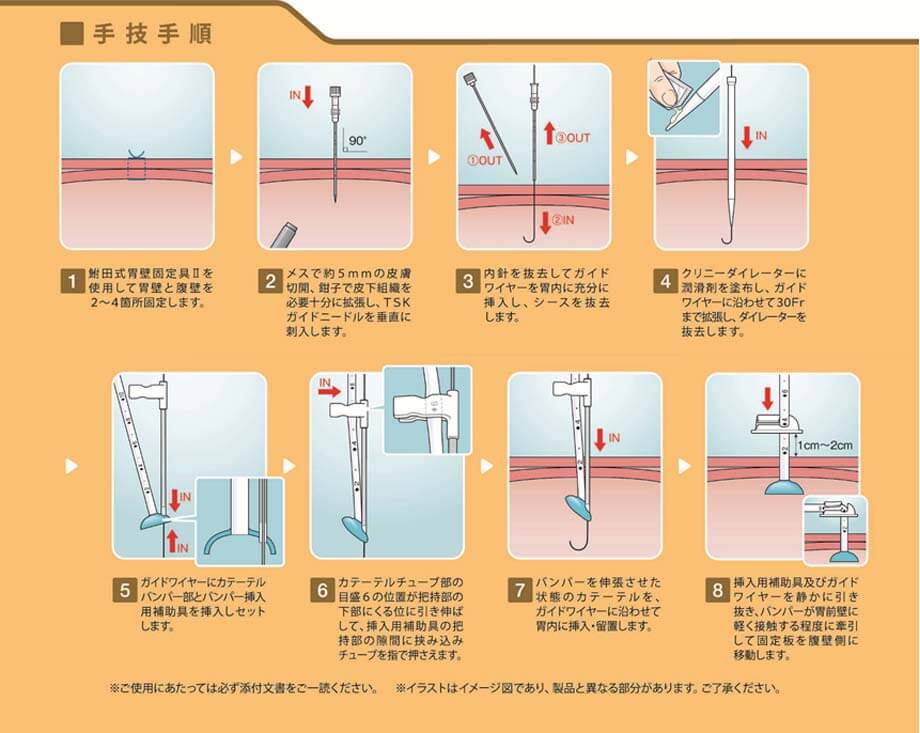 手技手順