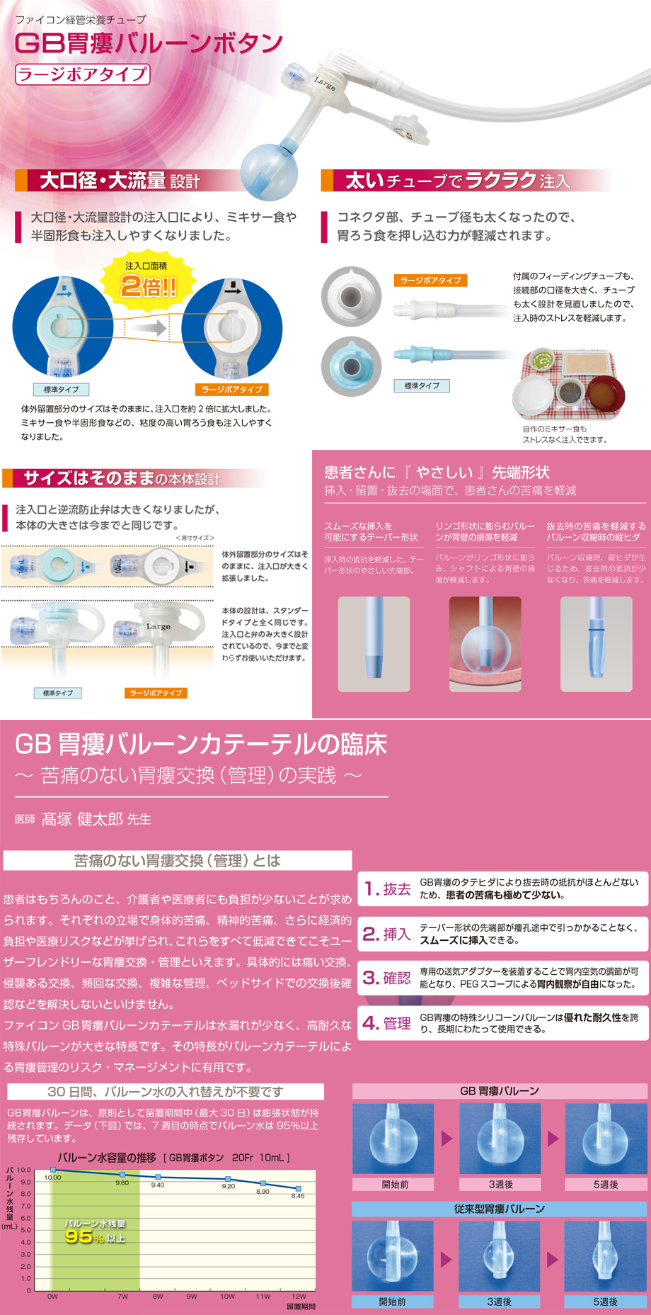 GB胃瘻バルーンボタン　ラージボアタイプの特徴：■大口径・大流量設計の注入口により、ミキサー食や半固形食も注入しやすくなりました。■太いチューブでラクラク注入：コネクタ部、チューブ径も太くなったので、胃ろう食を押し込む力が軽減されます■サイズはそのままの本体設計：注入口と逆流防止弁は大きくなりましたが、本体の大きさは今までと同じです。GB 胃瘻バルーンカテーテルの臨床～ 苦痛のない胃瘻交換（管理）の実践 ～医師 髙塚 健太郎 先生.患者はもちろんのこと、介護者や医療者にも負担が少ないことが求められます。それぞれの立場で身体的苦痛、精神的苦痛、さらに経済的負担や医療リスクなどが挙げられ、これらをすべて低減できてこそユーザーフレンドリーな胃瘻交換・管理といえます。具体的には痛い交換、侵襲ある交換、頻回な交換、複雑な管理、ベッドサイドでの交換後確認などを解決しないといけません。ファイコンGB 胃瘻バルーンカテーテルは水漏れが少なく、高耐久な特殊バルーンが大きな特長です。その特長がバルーンカテーテルによる胃瘻管理のリスク・マネージメントに有用です。