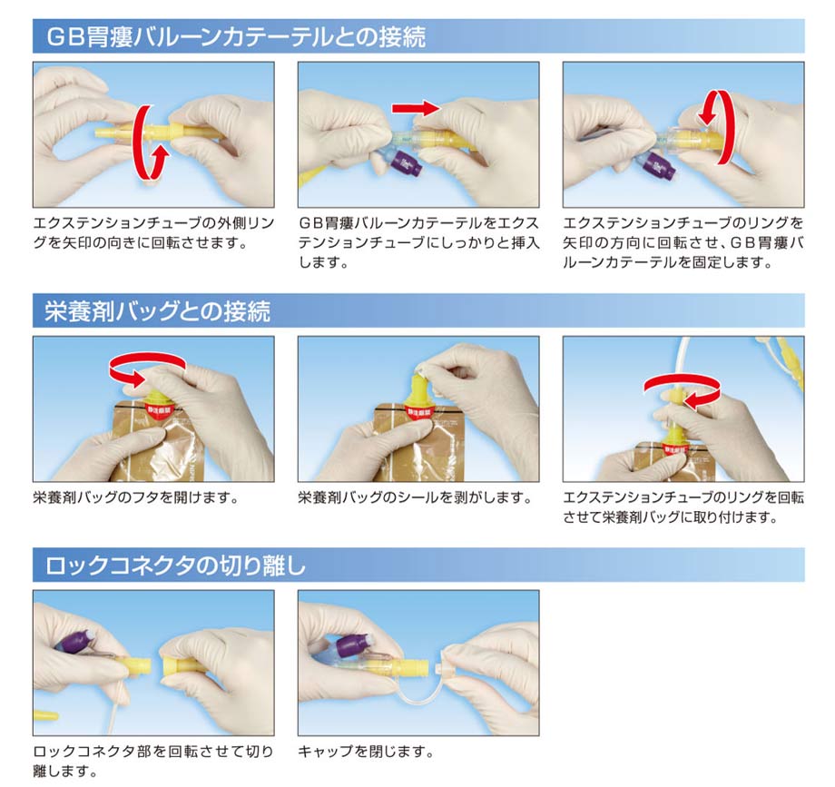 GB胃瘻バルーンカテーテルとの接続・栄養剤バッグとの接続・ロックコネクタの切り離し