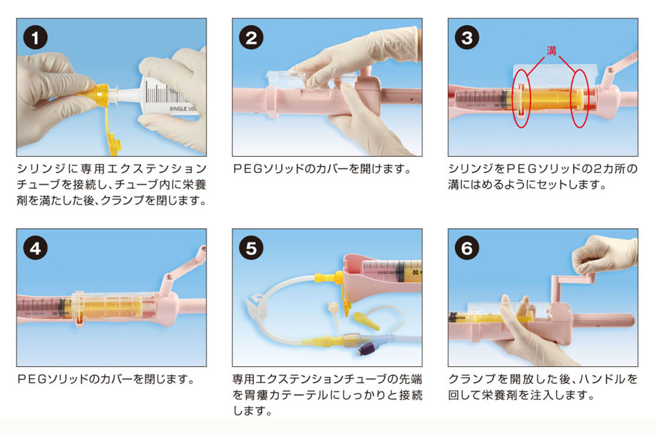 PEGソリッドの使用方法