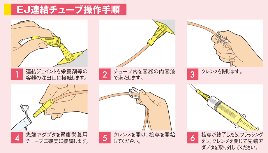 EJ連結チューブの操作手順