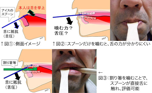 図11　舌の挙上訓練