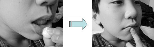 図3.味覚刺激法