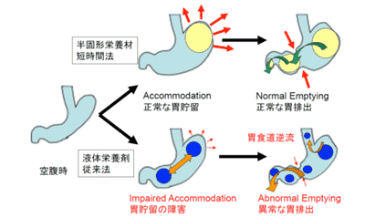 図１　胃瘻からの半固形化栄養材短時間注入法の機序　合田文則（2006年）